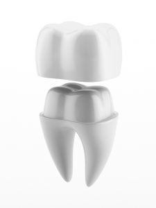 We are the best dentistry for dental crowns.